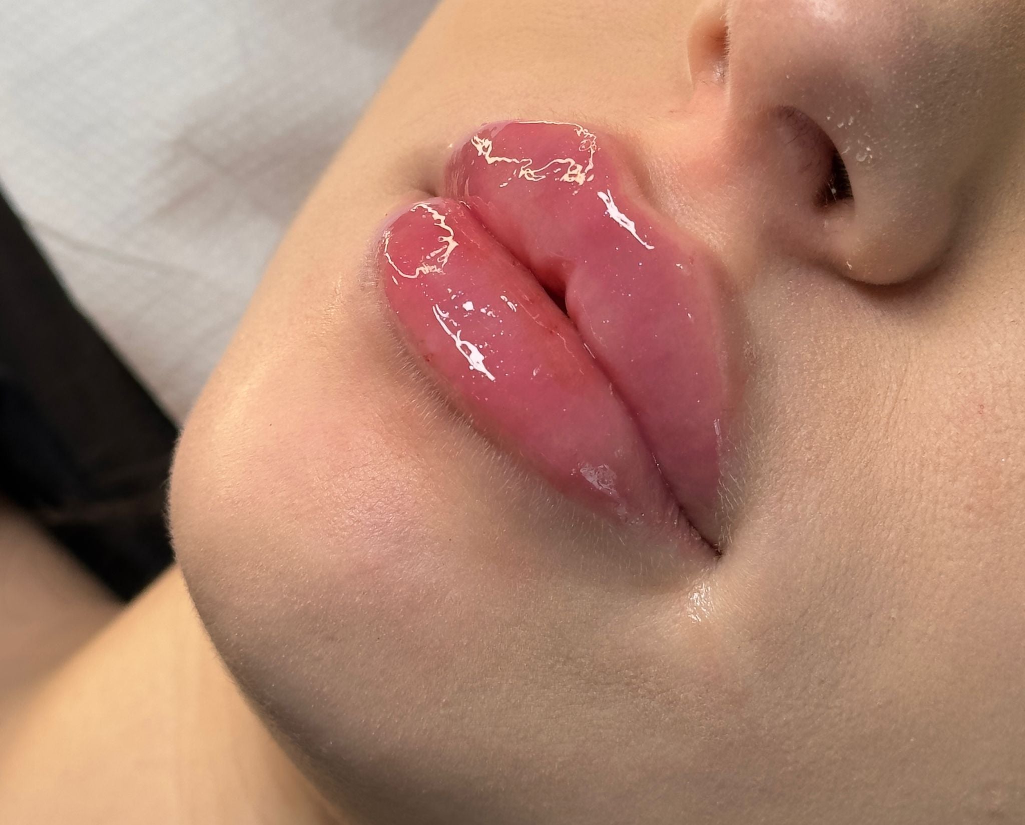 Estetică 22