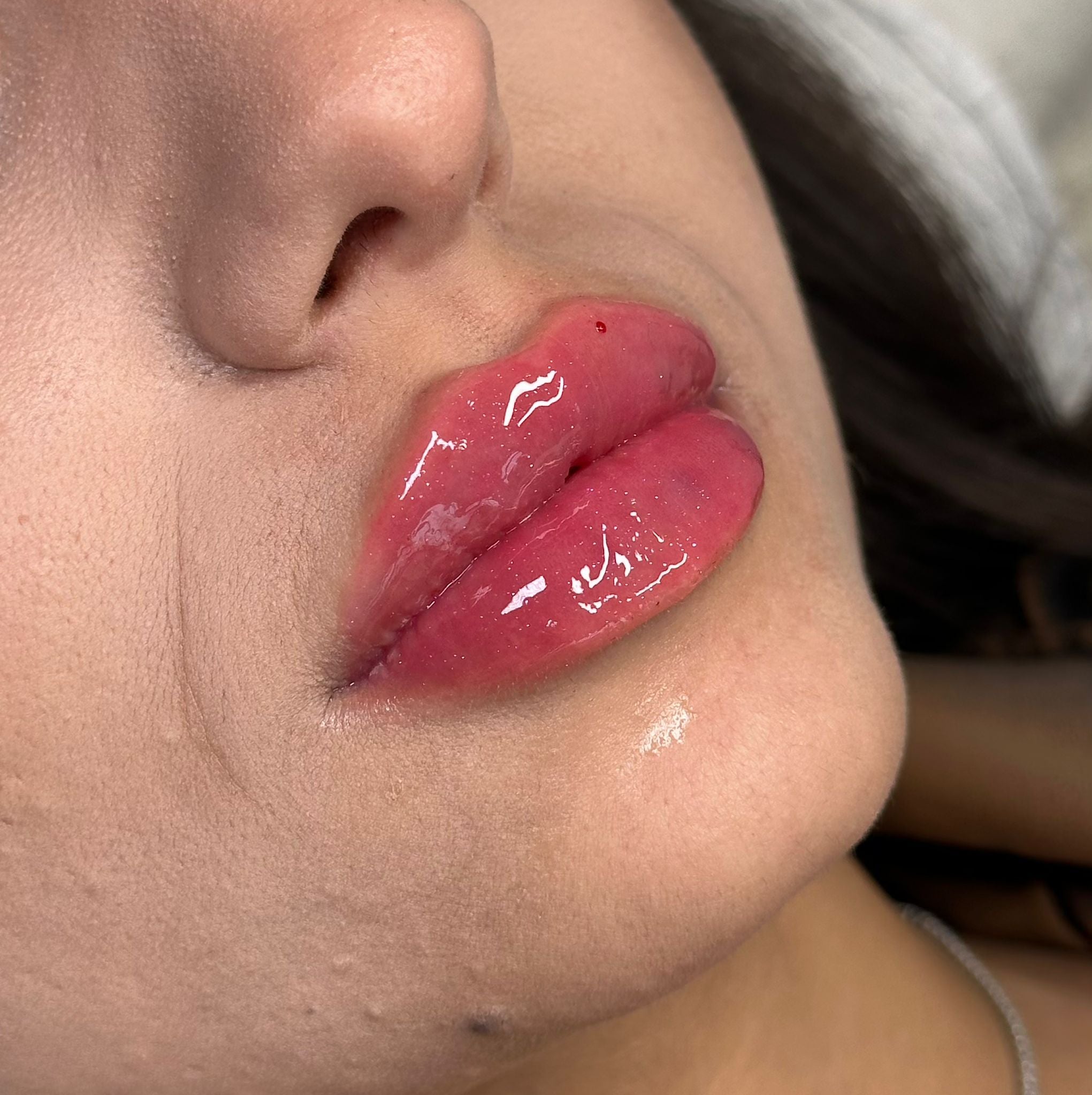 Estetică 25