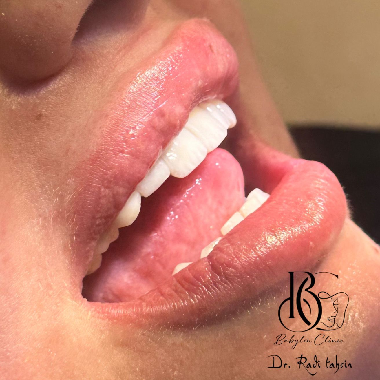Estetică 39